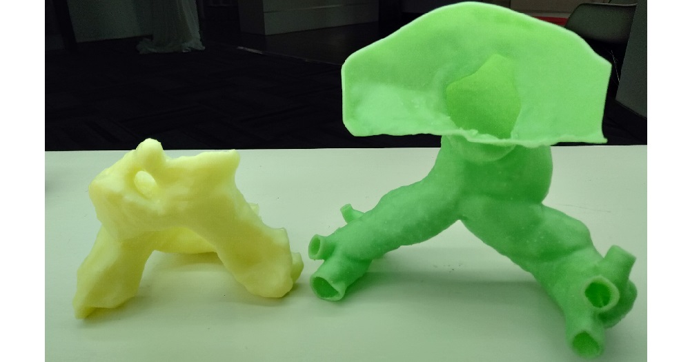 Mô hình xương 3D